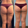 Praxisratgeber: Pressotherapie in eine Anti-Cellulite-Routine integrieren – Eclipse Beauty Tech