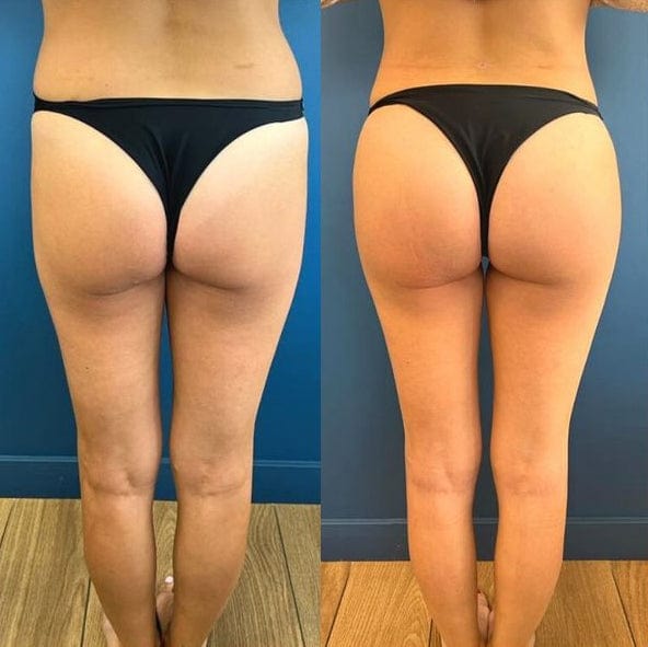 Jambes affinées
