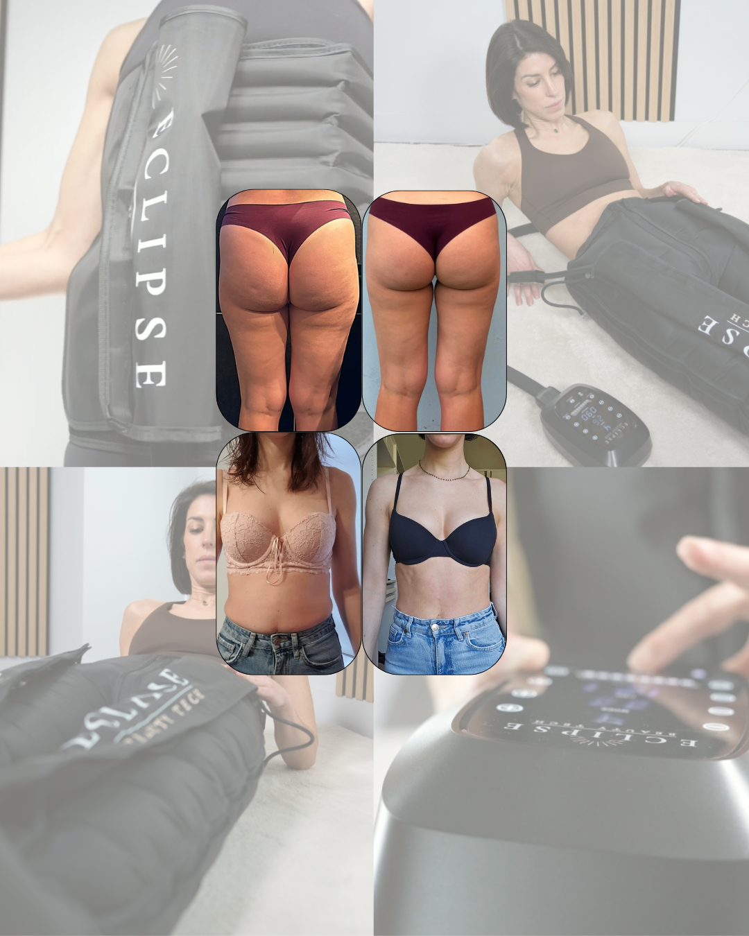 Coffret Pantalon & Ceinture de Pressothérapie - ECLIPSE© Wave Compression™ 8C Eclipse Groupe